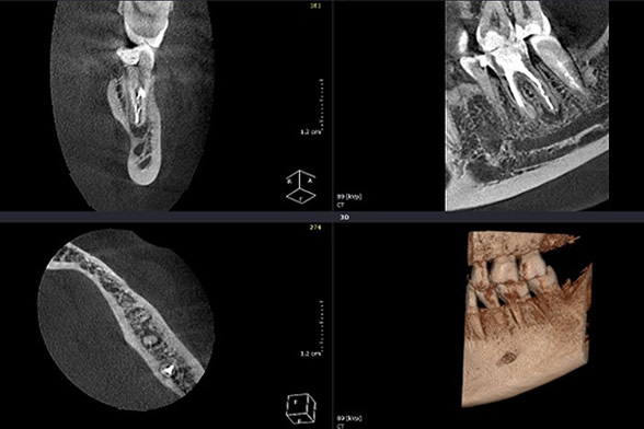 apexdental4