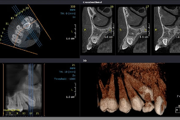 apexdental5